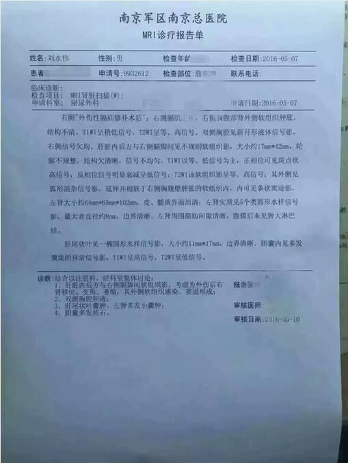去南京检查的术后“丢肾”男子确系右肾萎缩